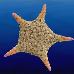 Baculogypsina sphaerulata